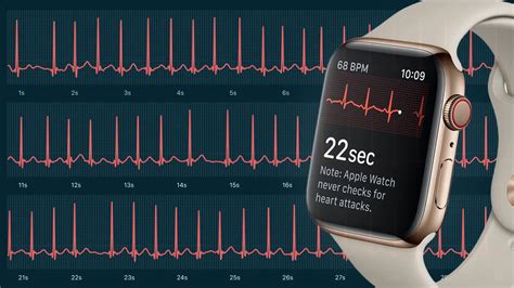 is apple watch ecg reliable